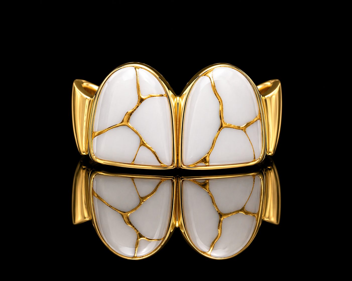 Kintsugi dental jewel — white ceramic veined with gold, an Atelier Fabbro signature finish